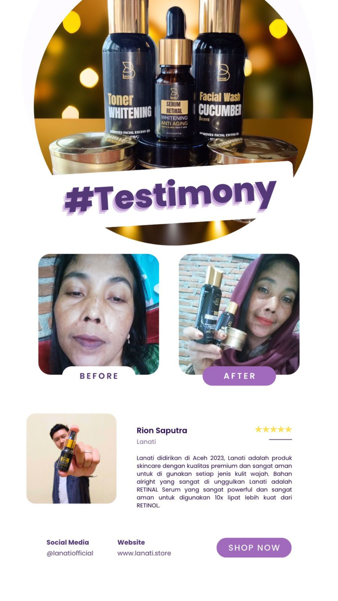 Apa kata mereka tentang lanati bersama ipemka (2) Apa kata mereka tentang lanati bersama ipemka (2)