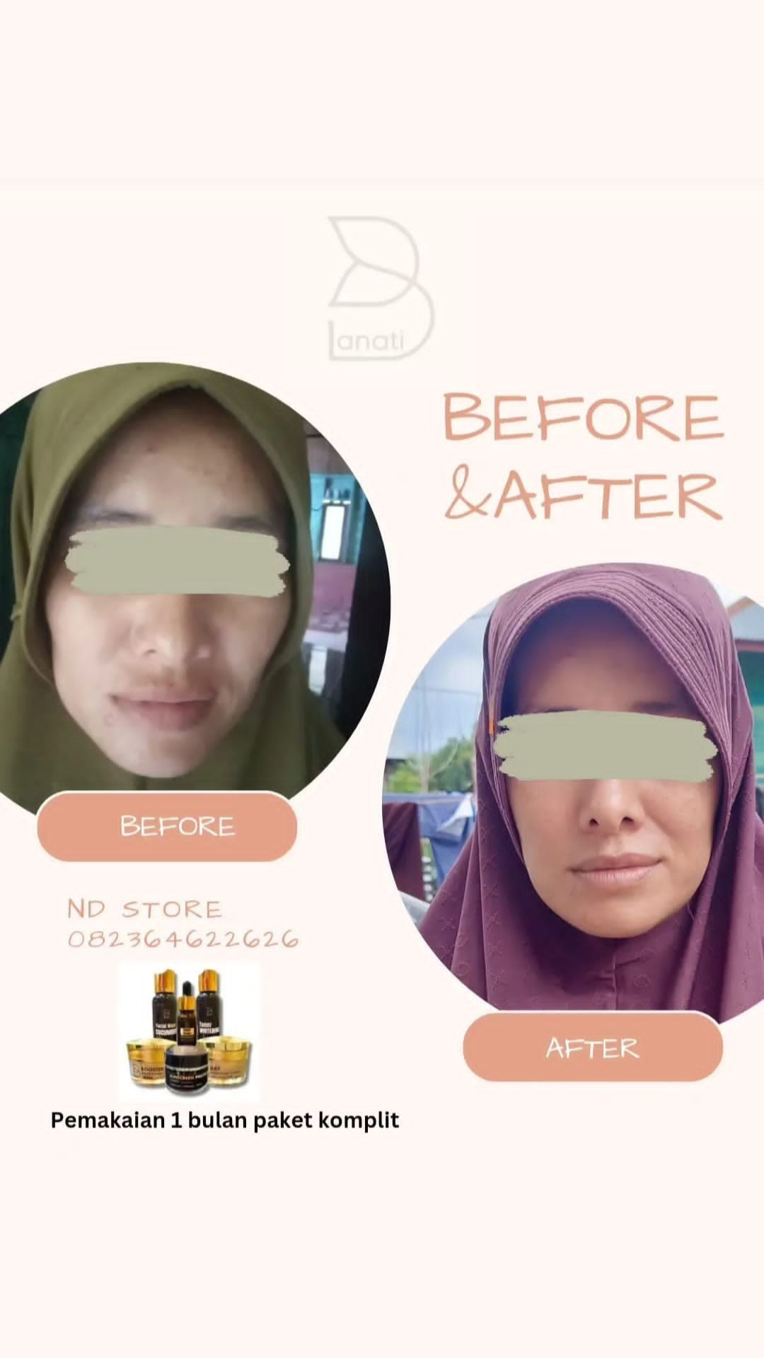 Apa kata mereka tentang lanati bersama ipemka (3) Apa kata mereka tentang lanati bersama ipemka (3)