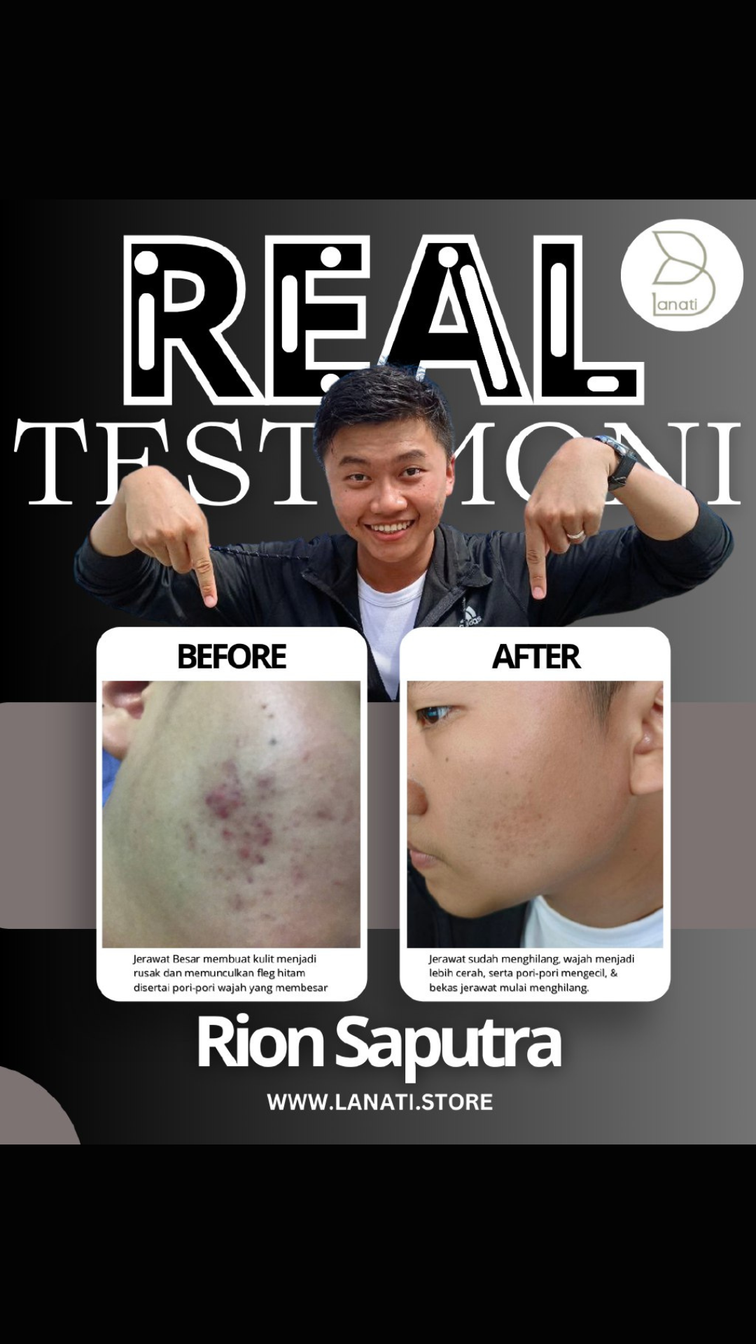 Apa kata mereka tentang lanati bersama ipemka (5) Apa kata mereka tentang lanati bersama ipemka (5)